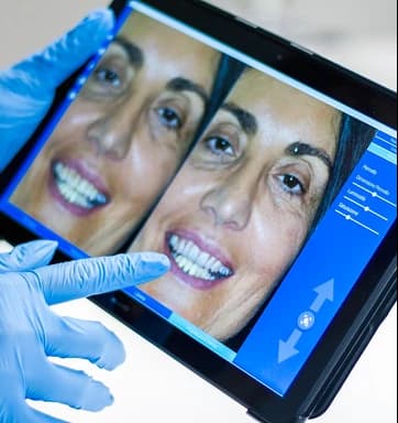 Integrazione Software