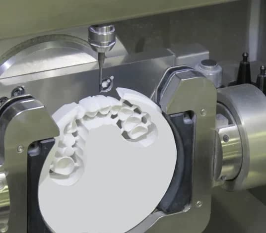 Dente pulito da un cottonfioc